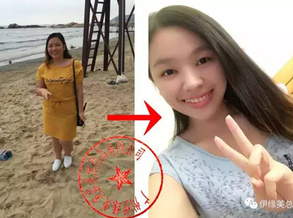 伊緣美(měi)廣東(dōng)省恩平店(diàn)顧客鄭巧玲