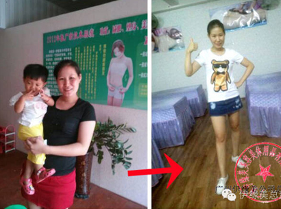 伊緣美(měi)廣東(dōng)省湛江市(shì)麻章(zhāng)店(diàn)顧客黃(huáng)引娣女(nǚ)士