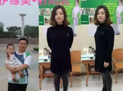 江蘇鹽城(chéng)射陽店(diàn)減肥案成功案例2